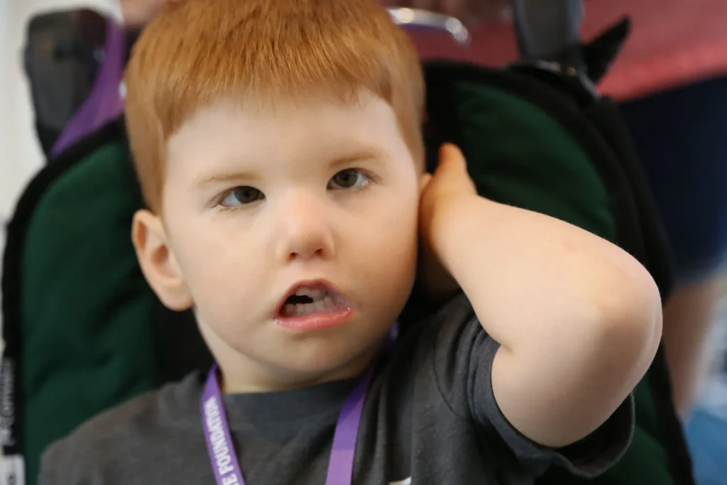 Moebius Sendromu: 23 Yıl Sonra Gülümseme